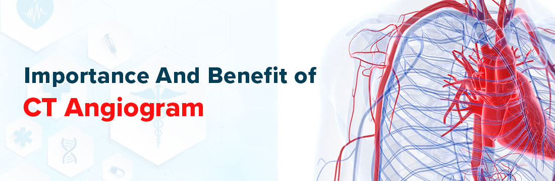 Importance and Benefit of CT Angiogram